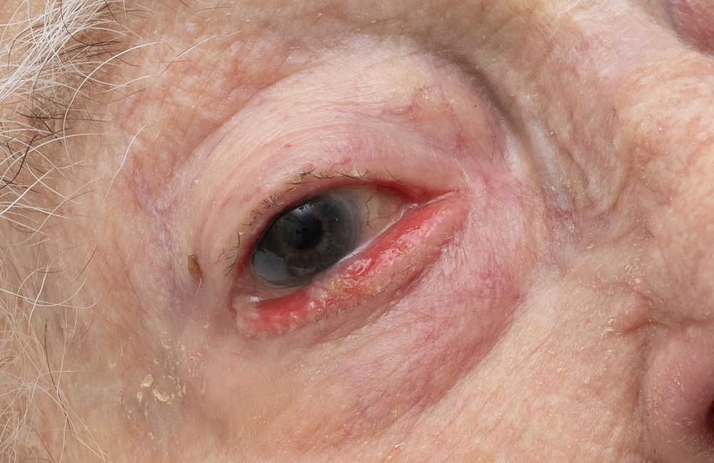 Please pierce your bones into mine